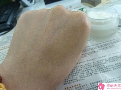 福州市凹陷疤痕激光手術(shù)的醫(yī)院哪家機(jī)構(gòu)好-凹陷疤痕激光手術(shù)價(jià)格究竟是多少